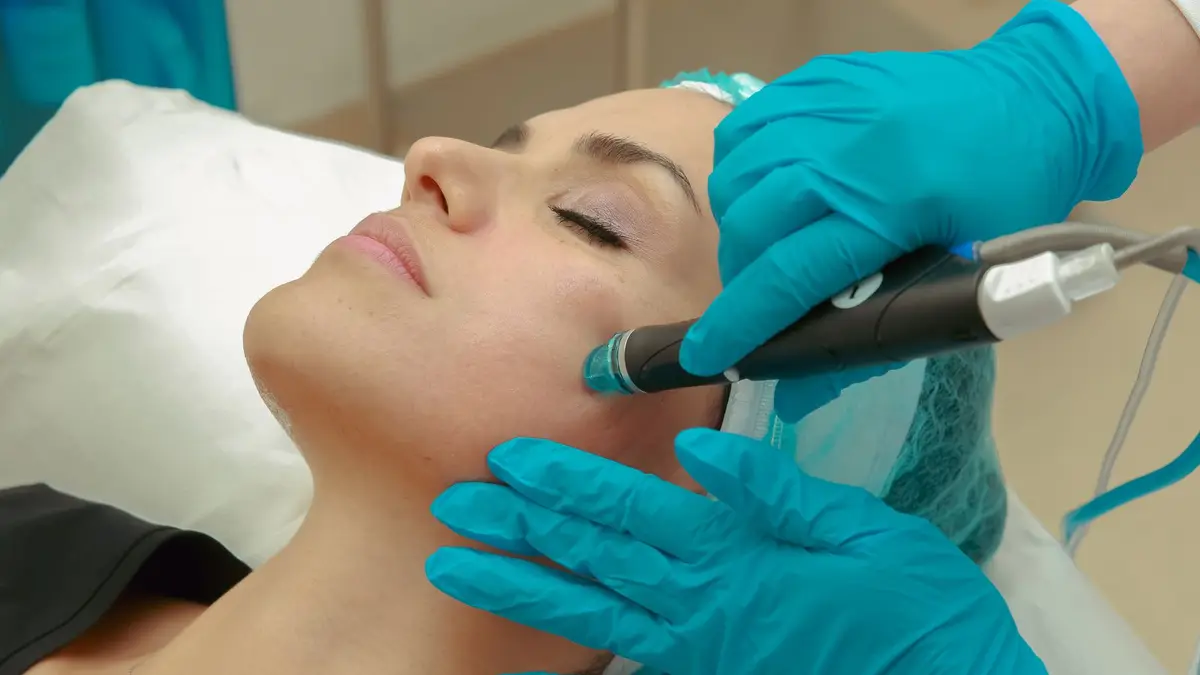 Hydrafacial vs Kimyasal Peeling: Hangisi Sana Uygun?